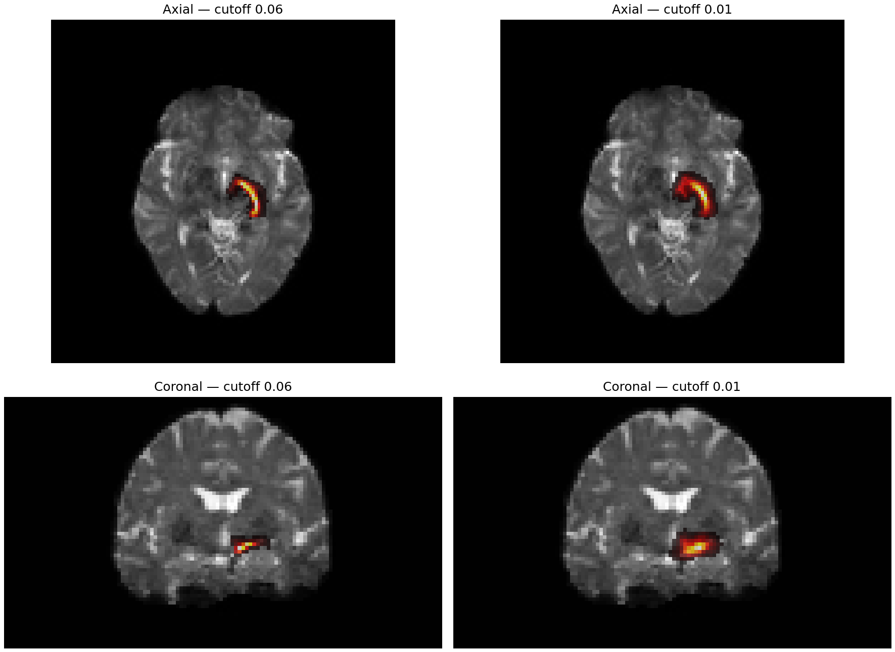 Tract-density images at cutoff 0.06 and 0.01